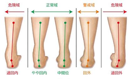 靴 内側 に 安い 傾く